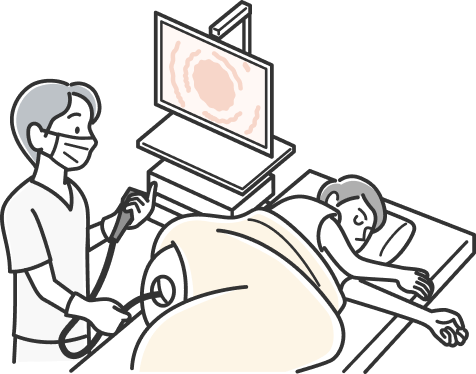 大腸内視鏡検査のイラスト